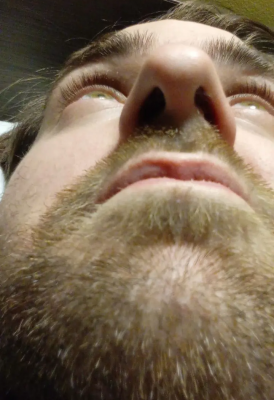 Photos de superfetatoire